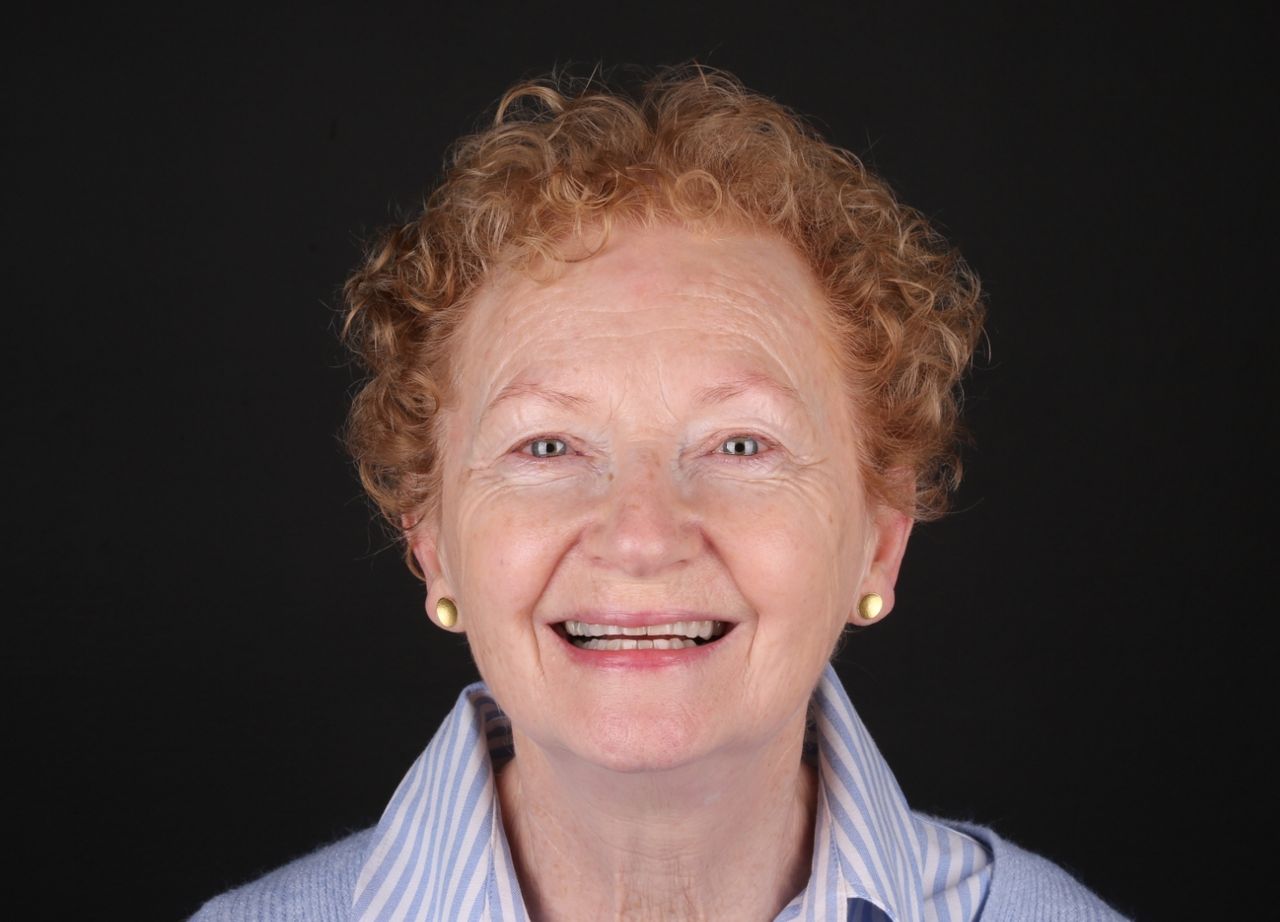 Seapoint full-arch implant patient