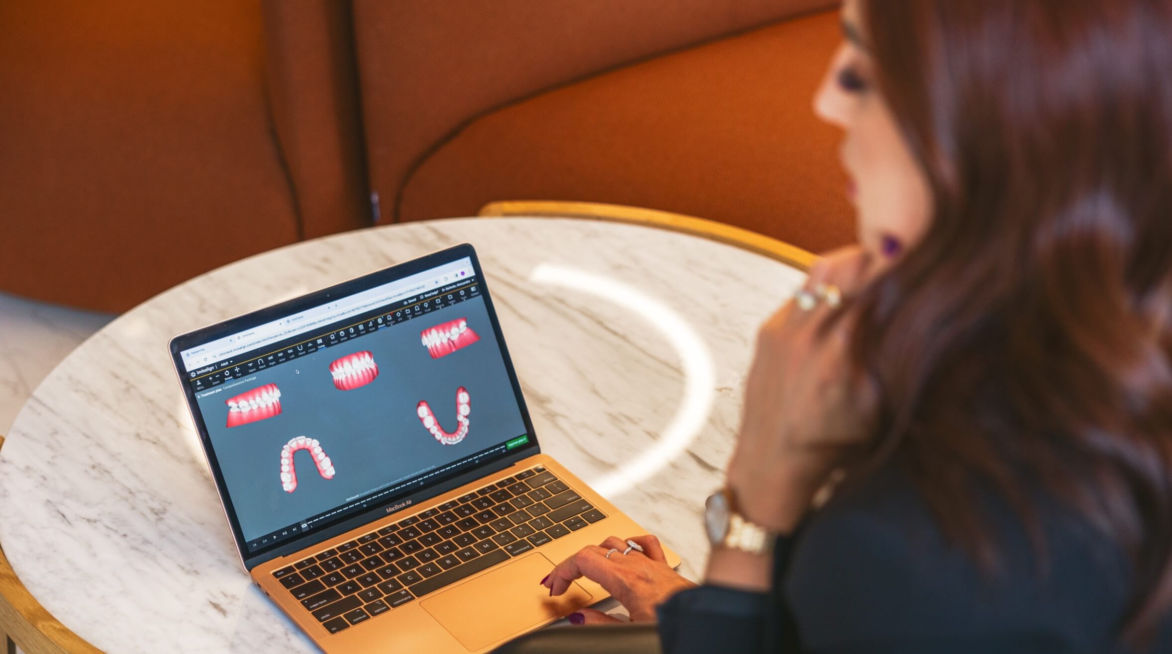 Dental implant procedure at Seapoint